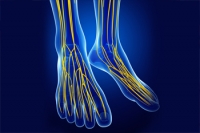How Peroneal Neuropathy Affects the Feet