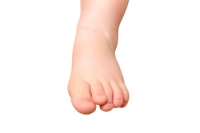 Children’s Foot Alignment Deformities