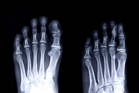Several Categories of Foot Bones