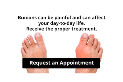 Are Bunions Affecting Your Everyday Life?