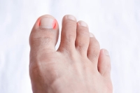 How to Tell if an Ingrown Toenail Is Infected