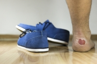 Several Reasons Why Blisters Can Develop